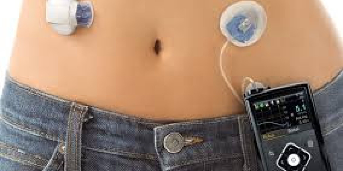 Insulin Pump Market Size And Forecast Report 2024-2032